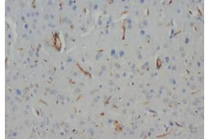 Immunohistochemistry (IHC) image for anti-Neurofilament, Heavy Polypeptide (NEFH) (C-Term) antibody (ABIN1108414) (NEFH 抗体  (C-Term))