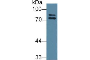 Western Blot; Sample: Rat Liver lysate; Primary Ab: 1µg/ml Rabbit Anti-Rat OS9 Antibody Second Ab: 0. (OS9 抗体  (AA 465-666))