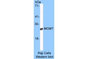 Image no. 1 for anti-O6-Methylguanine-DNA-Methyltransferase (MGMT) (AA 8-221) antibody (ABIN6560107)
