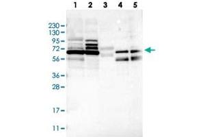 Western blot analysis of Lane 1: RT-4, Lane 2: U-251 MG, Lane 3: Human Plasma, Lane 4: Liver, Lane 5: Tonsil with MUM1L1 polyclonal antibody . (MUM1L1 抗体)
