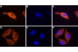 Expression of STIM2 in RBL cells - Immunocytochemical staining of paraformaldehyde-fixed and permeabilized rat basophilic leukemia (RBL) cells. (Stim2 抗体  (C-Term, Intracellular))