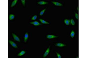 Immunofluorescent analysis of Hela cells using ABIN7167611 at dilution of 1:100 and Alexa Fluor 488-congugated AffiniPure Goat Anti-Rabbit IgG(H+L) (RGS4 抗体  (AA 1-205))