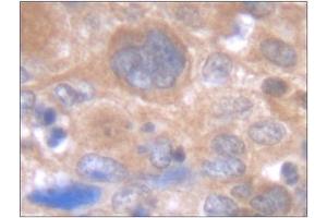 Image no. 2 for anti-Interleukin 6 (IL6) antibody (ABIN181728) (IL-6 抗体)