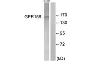 Western blot analysis of extracts from K562 cells, using GPR158 Antibody. (GPR158 抗体  (AA 1-50))