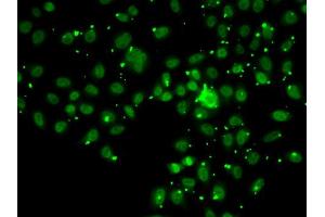 Immunofluorescence analysis of A549 cell using ATRIP antibody. (ATRIP 抗体)