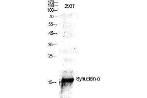 Western Blotting (WB) image for anti-Synuclein, alpha (SNCA) (Tyr1112) antibody (ABIN3177574) (SNCA 抗体  (Tyr1112))