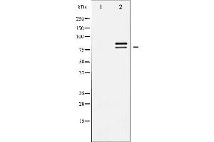 Western blot analysis of HSL expression in CalyculinA treated HeLa whole cell lysates,The lane on the left is treated with the antigen-specific peptide. (LIPE 抗体  (Internal Region))
