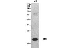 Western Blot analysis of hela cells using PTN Polyclonal Antibody.