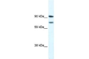 WB Suggested Anti-ZFHX1B Antibody Titration: 0. (ZEB2 抗体  (N-Term))