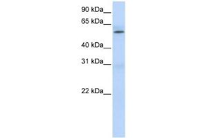 PRMT3 antibody used at 1 ug/ml to detect target protein. (PRMT3 抗体  (Middle Region))