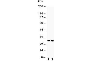 Western blot testing of VEGF antibody (A isoform) and Lane 1:  rat thymus;  2: rat brain lysate (VEGFA 抗体  (AA 27-191))