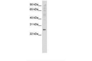 Image no. 1 for anti-Synaptosomal-Associated Protein, 25kDa (SNAP25) (C-Term) antibody (ABIN6736141) (SNAP25 抗体  (C-Term))