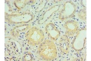 Immunohistochemistry of paraffin-embedded human kidney tissue using ABIN7143467 at dilution of 1:100 (GGA2 抗体  (AA 1-300))