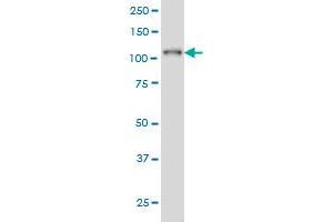 PTK2B monoclonal antibody (M02A), clone 3G2 Western Blot analysis of PTK2B expression in K-562 (  ). (PTK2B 抗体  (AA 682-871))