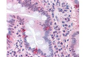 Anti-SEMA4B antibody IHC of human small intestine. (SEMA4B 抗体  (Internal Region))