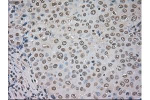 Image no. 1 for anti-Cancer/testis Antigen 1B (CTAG1B) antibody (ABIN1499899) (CTAG1B 抗体)