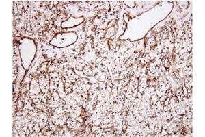 Immunohistochemistry (IHC) image for anti-Clusterin (CLU) (AA 1-333), (N-Term) antibody (ABIN317504) (Clusterin 抗体  (N-Term))