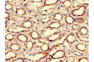 Immunohistochemistry of paraffin-embedded human kidney tissue using ABIN7155305 at dilution of 1:100 (HDAC1 抗体  (AA 207-412))