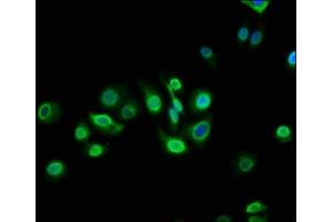 Immunofluorescence staining of HepG2 cells with ABIN7172938 at 1:133, counter-stained with DAPI. (TM6SF2 抗体  (AA 290-331))