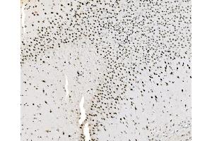 IHC analysis of JUNB using anti-JUNB antibody (ABIN7603223). (JunB 抗体  (N-Term))