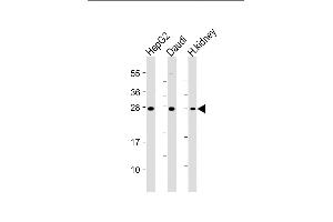 All lanes : Anti-HAVCR2 Antibody at 1:4000 dilution Lane 1: HepG2 whole cell lysate Lane 2: Daudi whole cell lysate Lane 3: Human kidney lysate Lysates/proteins at 20 μg per lane. (TIM3 抗体)