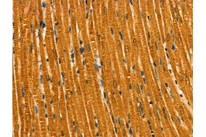 Phospho-RAB7L1 (Thr71) Antibody at 1/100 staining Rat heart tissue by IHC-P. (RAB7L1 抗体  (pThr71))