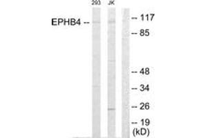 Western Blotting (WB) image for anti-EPH Receptor B4 (EPHB4) (AA 571-620) antibody (ABIN2889520) (EPH Receptor B4 抗体  (AA 571-620))