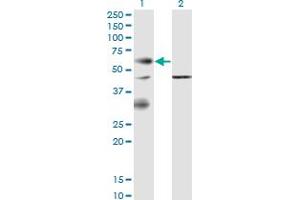 Western Blot analysis of EPOR expression in transfected 293T cell line by EPOR monoclonal antibody (M02), clone 3F6. (EPOR 抗体  (AA 31-130))