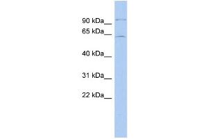 WB Suggested Anti-INSM2 Antibody Titration: 0. (INSM2 抗体  (Middle Region))