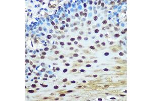 Immunohistochemistry of paraffin-embedded human esophageal using hnRNP K Rabbit mAb (ABIN7267634) at dilution of 1:100 (40x lens). (HNRNPK 抗体)