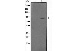 Western blot analysis on A549 cell lysate using CERKL Antibody,The lane on the left is treated with the antigen-specific peptide. (CERKL 抗体  (Internal Region))