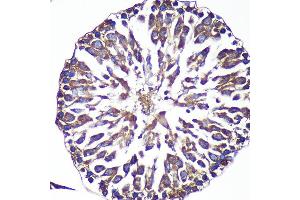 Immunohistochemistry of paraffin-embedded Rat testis using  Rabbit pAb (ABIN7265603) at dilution of 1:100 (40x lens). (ANKLE2 抗体  (AA 350-450))