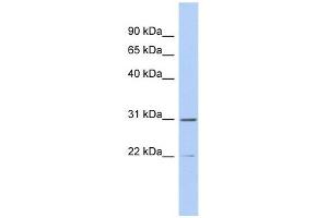 Western Blotting (WB) image for anti-Zinc Finger, C3HC-Type Containing 13 (ZCCHC13) (Middle Region) antibody (ABIN632852)