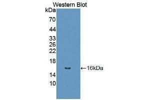 Detection of Recombinant DRD1, Human using Polyclonal Antibody to Dopamine Receptor D1 (DRD1) (Dopamine Receptor d1 抗体  (AA 338-446))