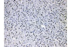 IHC testing of FFPE rat liver tissue with HDGF antibody at 1ug/ml. (HDGF 抗体  (AA 61-97))