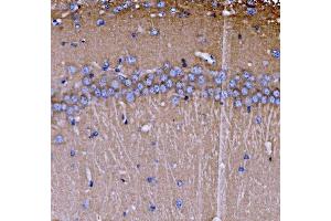 IHC analysis of SH3GL2 using anti-SH3GL2 antibody (ABIN7602229). (SH3G2 抗体  (AA 65-292))