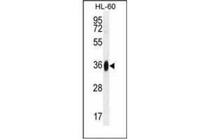 Western blot analysis of GGH Antibody (N-term) in HL-60 cell line lysates (35ug/lane). (GGH 抗体  (N-Term))
