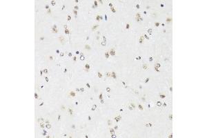 Immunohistochemistry of paraffin-embedded mouse brain using EFTUD2 Antibody (ABIN5974236) at dilution of 1/100 (40x lens). (EFTUD2 抗体)