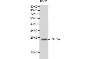 Western blot analysis of extracts of K-562 cells, using RAB7A antibody (ABIN5970501). (RAB7A 抗体)