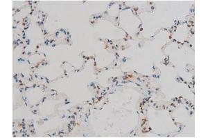 ABIN6267411 at 1/200 staining Rat lung tissue sections by IHC-P. (JunD 抗体  (pSer255))