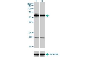 Western Blotting (WB) image for anti-phosphoinositide Kinase, FYVE Finger Containing (PIKFYVE) (AA 342-452) antibody (ABIN599337) (PIKFYVE 抗体  (AA 342-452))