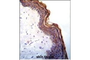 Kallikrein 7(KLK7) Antibody (C-term) (ABIN652198 and ABIN2840744) immunohistochemistry analysis in formalin fixed and paraffin embedded human skin tissue followed by peroxidase conjugation of the secondary antibody and DAB staining. (Kallikrein 7 抗体  (C-Term))