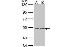 Western Blotting (WB) image for anti-Cytochrome P450, Family 4, Subfamily A, Polypeptide 11 (CYP4A11) (Center) antibody (ABIN2855647)