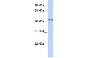 WB Suggested Anti-B3GNT4 Antibody Titration:  0. (B3GNT4 抗体  (N-Term))