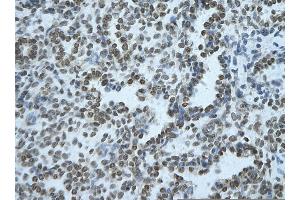 Rabbit Anti-BHLHE40 Antibody       Paraffin Embedded Tissue:  Human alveolar cell   Cellular Data:  Epithelial cells of renal tubule  Antibody Concentration:   4. (BHLHE40 抗体  (Middle Region))