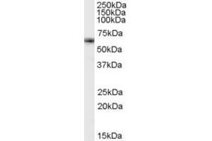 ABIN190813 (1µg/ml) staining of K562 cell lysate (35µg protein in RIPA buffer). (FOXO4 抗体  (Internal Region))