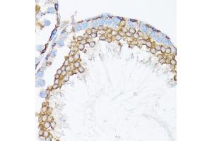 Immunohistochemistry of paraffin-embedded mouse testis using CTNNA1 antibody. (CTNNA1 抗体)