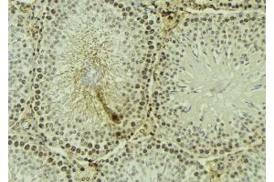 ABIN6267614 at 1/100 staining Mouse testis tissue by IHC-P. (PKC zeta 抗体  (pThr560))