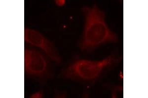 Immunofluorescence staining of methanol-fixed Hela cells using NFkB-p105(Phospho-Ser927) Antibody.
