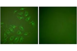 Immunofluorescence (IF) image for anti-Matrix Metallopeptidase 13 (Collagenase 3) (MMP13) (AA 10-59) antibody (ABIN2889227) (MMP13 抗体  (AA 10-59))